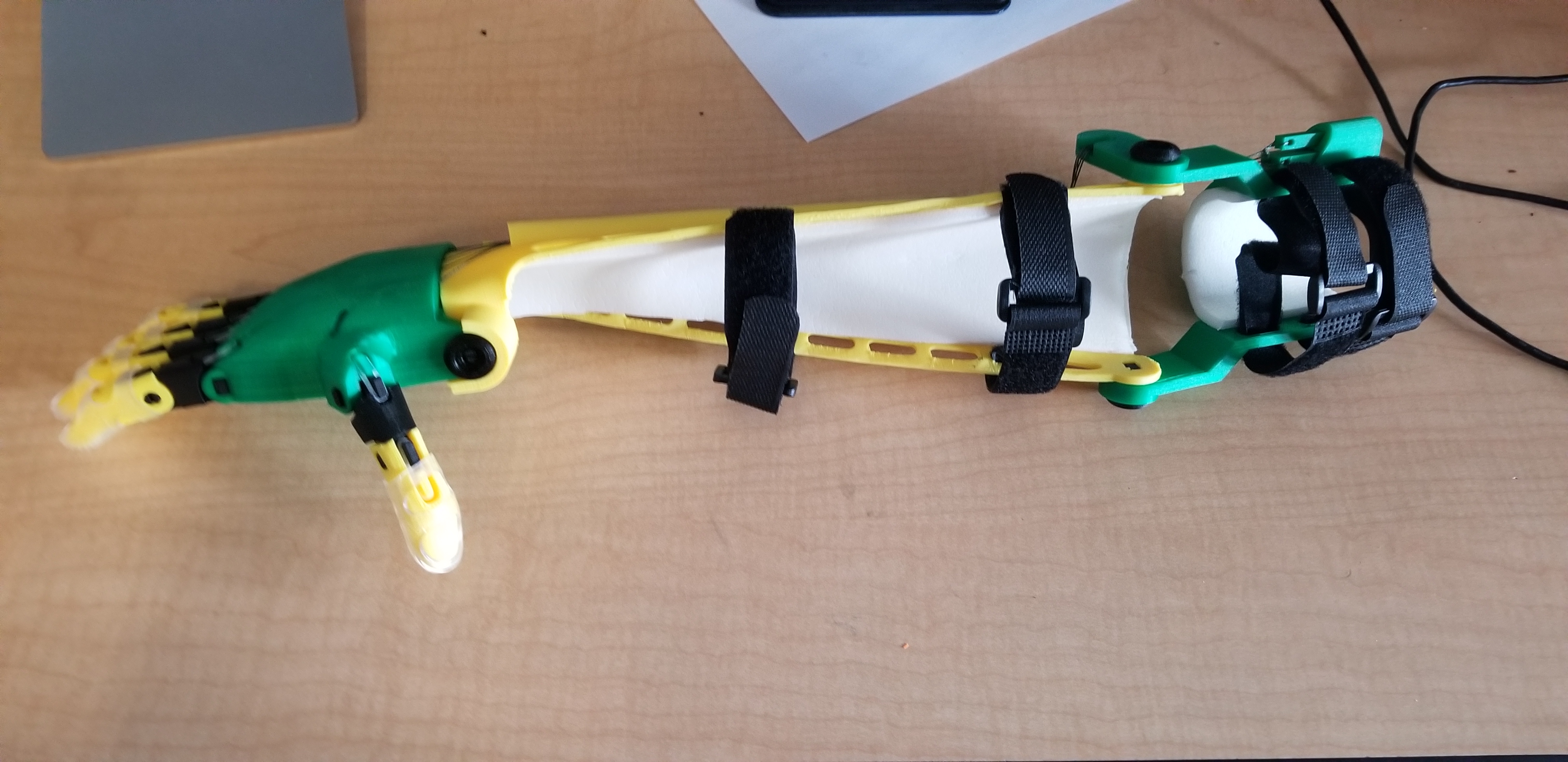 Prosthetic Arm